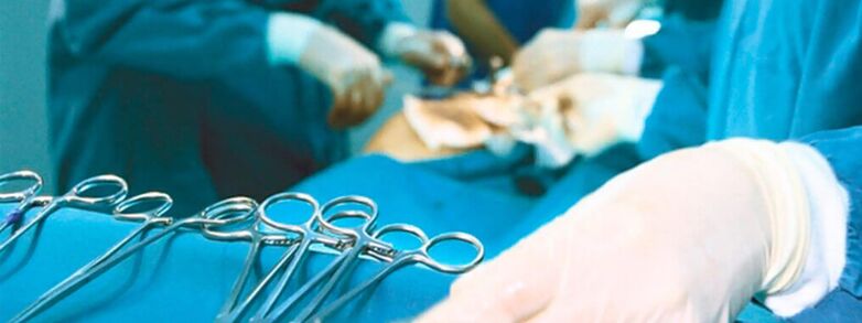 Kirurgjia e zmadhimit të penisit e kryer nga një kirurg
